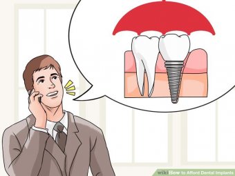 Image titled Afford Dental Implants Step 1