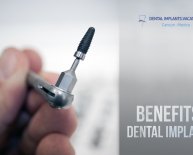 Are Dental Implants safe